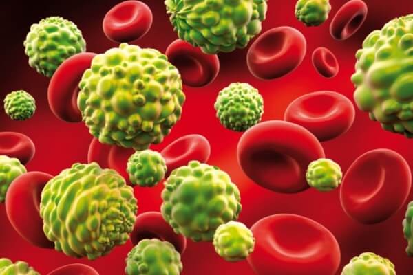 Η πρωτοποριακή θεραπεία που καταστρέφει τα καρκινικά κύτταρα δεν καλύπτεται από τον ΕΟΠΥΥ