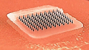 Νέο πειραματικό δερματικό επίθεμα για τη χορήγηση εμβολίου Covid-19 φαίνεται πιο αποτελεσματικό από τις ενέσεις