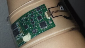 Ένας νέος αισθητήρας ιδρώτα που φοριέται στον καρπό του χεριού, βοηθά στη διάγνωση της κυστικής ίνωσης και του διαβήτη