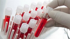 Νέο τεστ αίματος ανιχνεύει όχι μόνο τον καρκίνο, αλλά και πού αυτός αναπτύσσεται στο σώμα