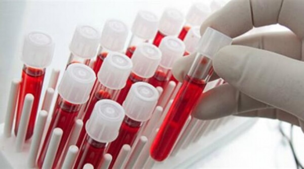 Νέο τεστ αίματος ανιχνεύει όχι μόνο τον καρκίνο, αλλά και πού αυτός αναπτύσσεται στο σώμα