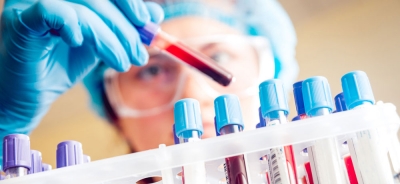 Ένα πειραματικό καθολικό τεστ αίματος μπορεί να κάνει διάγνωση οποιουδήποτε καρκίνου μέσα σε μόνο δέκα λεπτά